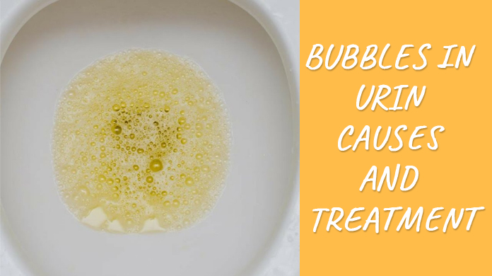 learn-reason-of-having-bubbles-in-urine-and-is-it-ok-for-health