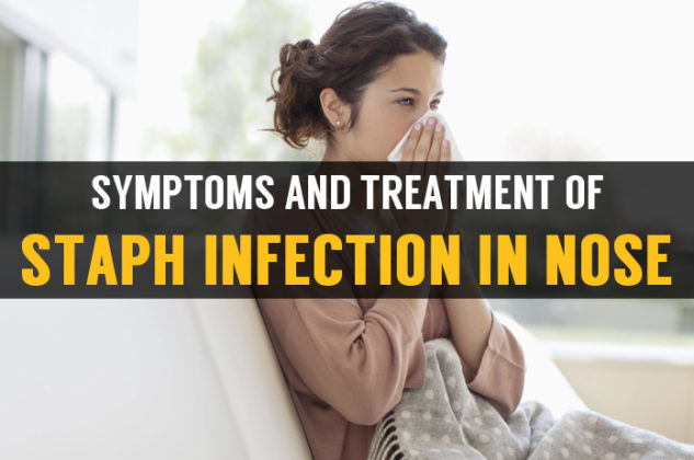 staph-infection-in-nose-learn-symptoms-and-treatment-tips