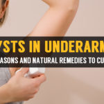 cysts in underarms reasons and natural remedies to cure