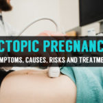 how to cope up with ectopic pregnancy