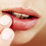 Lips Skin Inflammation Sores