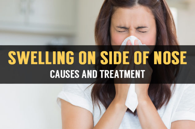 What Causes Nasal Swelling On One Side