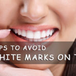 8 Tips To Avoid White Marks On Teeth