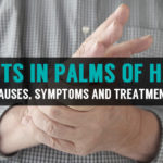 causes symptoms and treatment of knots in palms of hand