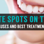 how to get rid of white spots on teeth