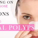 reasons for nasal polyps