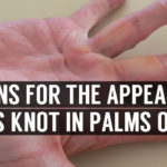 reasons for the appearance of knot in palms of hand