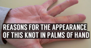 Knots and Lump in Palm of Hands | Symptoms & Home Treatment