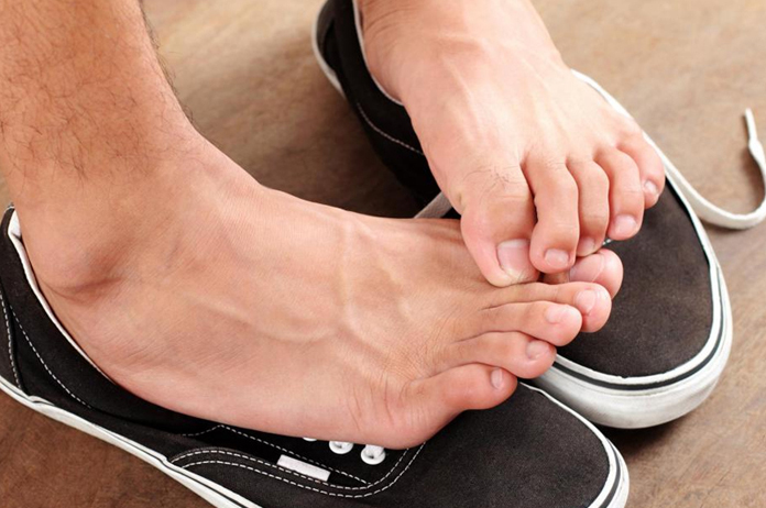 why-sole-of-feet-itchy-causes-and-home-remedies