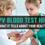 MPV in blood test and what it tells about your health