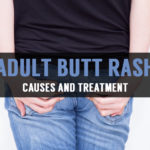 adult butt rash