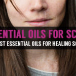 best essential oils for healing scars