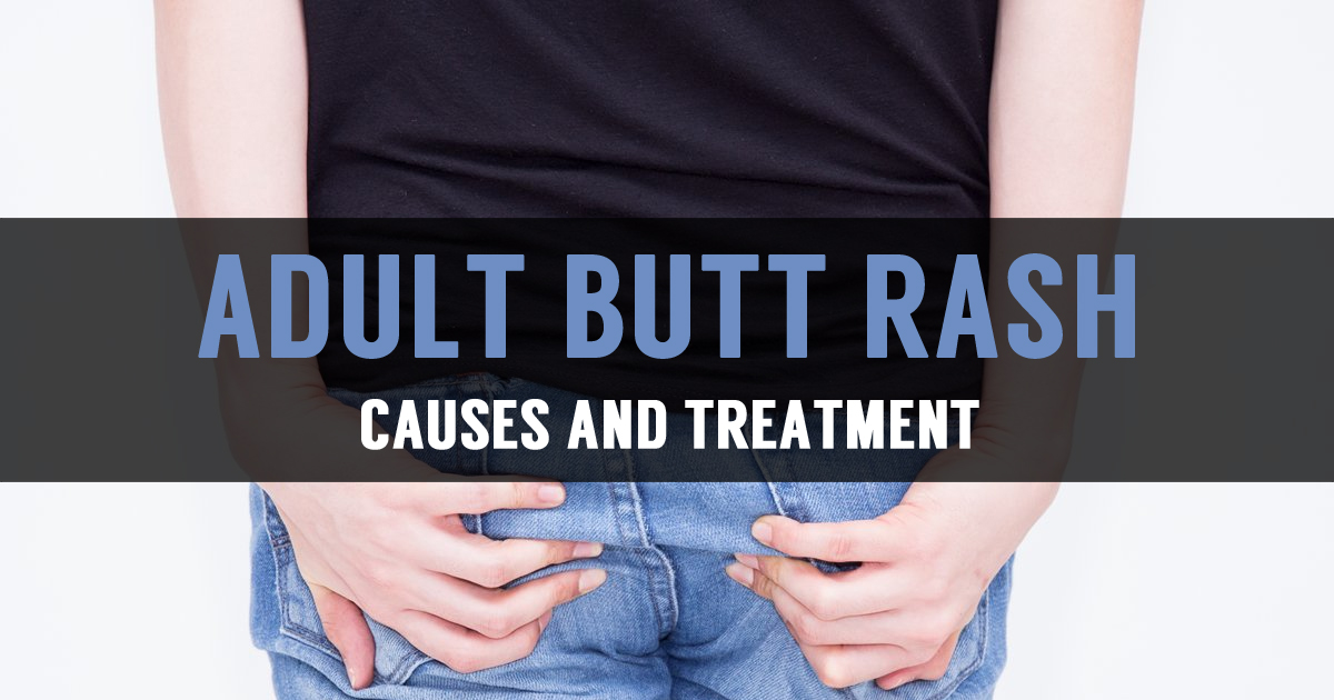 Learn About Adult Butt Rash And Its Treatment