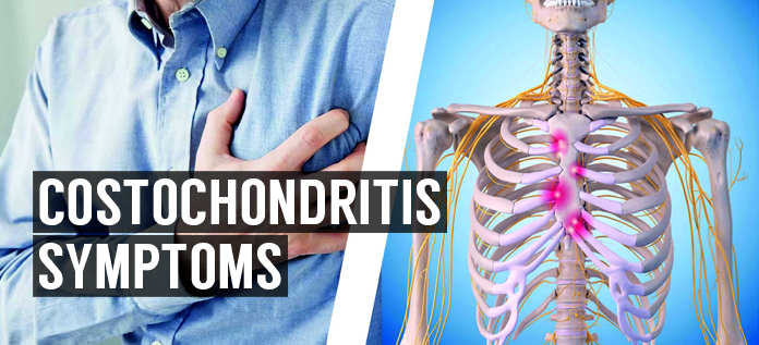 Best Way To Learn Costochondritis Reasons And Cures 3874