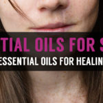 learn how to use essential oils for scars