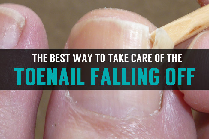 toenail-falling-off-learn-best-treatment-and-causes