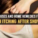 causes and home remedies for skin itching after shower