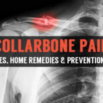 collarbone pain causes homeremedies and prevention