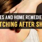 home remedies for skin and legs itching