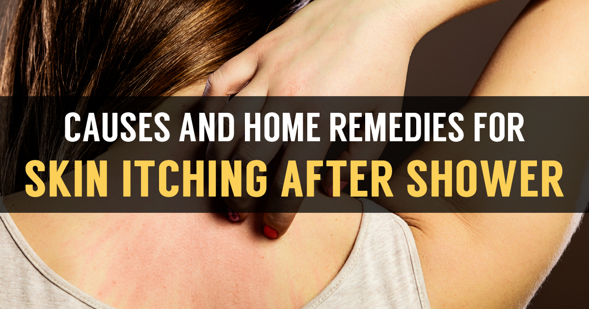 Learn Cause of Skin Itching After Shower with Natural Home Treatment