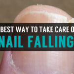 toenails coming off and best way to take care