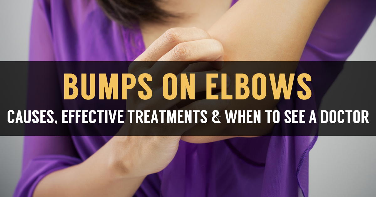 Itchy Bumps on Elbows Causes and Natural Treatment