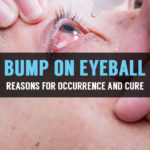 conjunctivitis or clear bump on eyeball