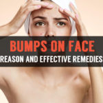 effective remedies to cure bumps on face