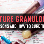 how to cure immature granulocytes