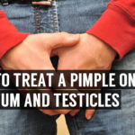 how to treat a pimple on scrotum and testicles