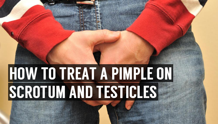 How To Treat A Pimple On Scrotum And Testicles
