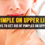 how to treat a pimple on upper lip