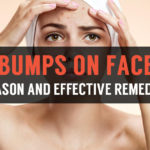 reason and effective treatments for bumps on face