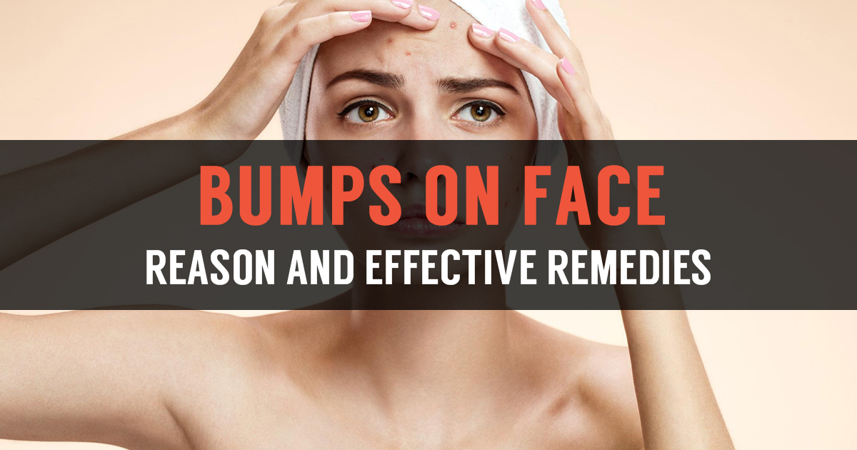 how-to-get-rid-of-tiny-bumps-on-face-how-to-get-rid-of-pimples-in-5