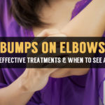 reasons and treatment for itchy bumps on elbows