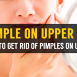 six ways to get rid of pimples on upper lip