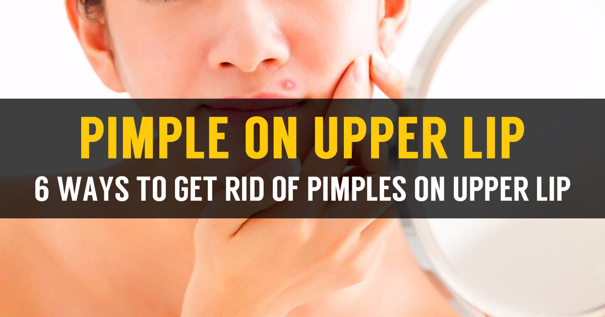 Learn How To Treat Pimple On Upper Lip And Causes