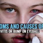 symptoms and causes of conjunctivitis or bump on eyeball