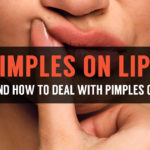 causes of pimples on lip and home treatments