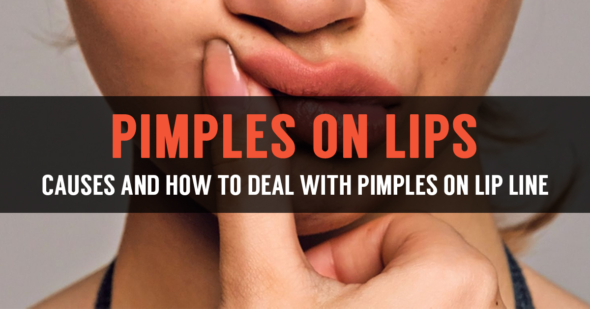 can you get a pimple on your vag lip