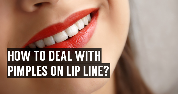 Pimples On Lip Causes And Learn How To Get Rid Of Pimples