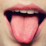 natural remedies to cure enlarged taste buds on tongue