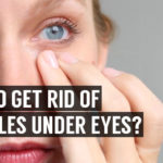 natural ways to remove under eye wrinkles