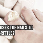 what causes toe nails to become brittle