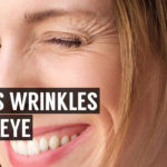 what causes wrinkles under the eyes of youth