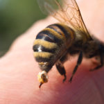 essential oils for bee sting