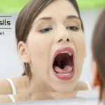 holes in tonsils causes with white stuff spots