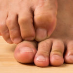 what is the exact cause of itchy soles of feet