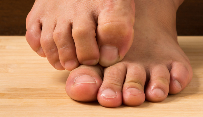 itchy-feet-at-night-learn-how-to-get-rid-from-itchy-sole-of-feet