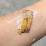 banana peel for skin to remove warts